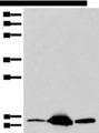 COX6A2 Antibody - Western blot analysis of Mouse heart tissue Human heart tissue Human muscle tissue lysates  using COX6A2 Polyclonal Antibody at dilution of 1:400