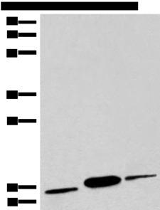 COX6A2 Antibody - Western blot analysis of Human muscle tissue Human heart tissue Mouse heart tissue lysates  using COX6A2 Polyclonal Antibody at dilution of 1:450