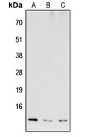 COX6B2 Antibody - Western blot analysis of COX6B2 expression in HEK293T (A); NS-1 (B); H9C2 (C) whole cell lysates.