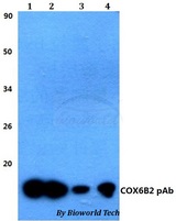 COX6B2 Antibody - Western blot of COX6B2 antibody at 1:500 dilution. Lane 1: HEK293T whole cell lysate. Lane 2: sp2/0 whole cell lysate. Lane 3: H9C4 whole cell lysate.