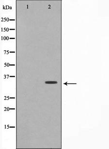 COX6C Antibody - Western blot analysis on HuvEc cell lysates using COX6C antibody. The lane on the left is treated with the antigen-specific peptide.