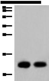 COX6C Antibody - Western blot analysis of Mouse heart tissue and Human heart tissue lysates  using COX6C Polyclonal Antibody at dilution of 1:800