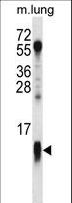 COX7A1 Antibody - COX7A1 Antibody western blot of mouse lung tissue lysates (35 ug/lane). The COX7A1 antibody detected the COX7A1 protein (arrow).