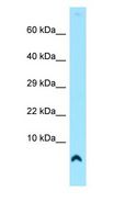 COX7A1 Antibody - COX7A1 antibody Western Blot of Human heart.  This image was taken for the unconjugated form of this product. Other forms have not been tested.