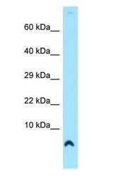 COX7A1 Antibody - COX7A1 antibody Western Blot of Human heart.  This image was taken for the unconjugated form of this product. Other forms have not been tested.