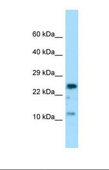 COX7A2 Antibody - Western blot of Human MCF7. COX7A2 antibody dilution 1.0 ug/ml.  This image was taken for the unconjugated form of this product. Other forms have not been tested.