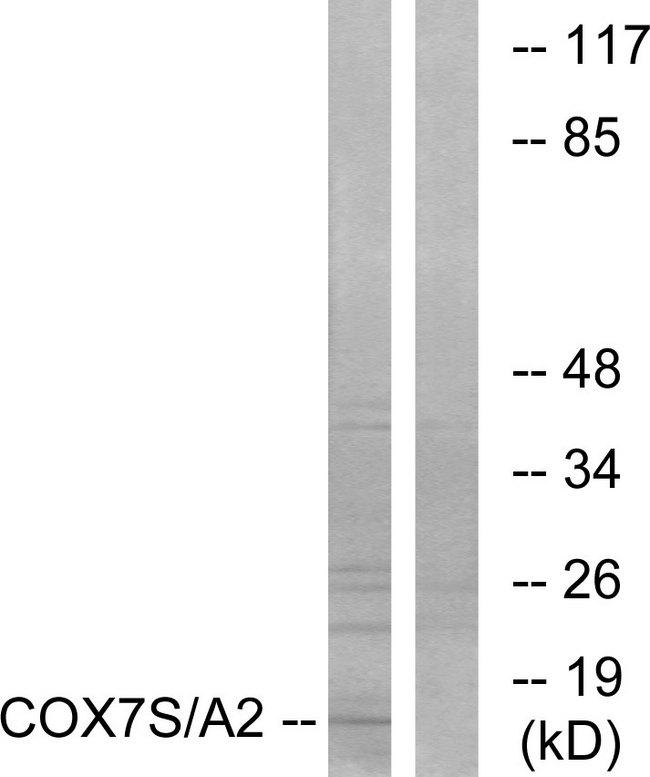 COX7A2 Antibody - Western blot analysis of extracts from rat heart cells, using COX7S/A2 antibody.