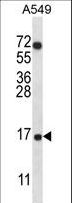 COX7A2L Antibody - COX7A2L Antibody western blot of A549 cell line lysates (35 ug/lane). The COX7A2L antibody detected the COX7A2L protein (arrow).
