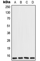 COX7A2L Antibody - Western blot analysis of COX7A2L expression in Jurkat (A); HeLa (B); Raw264.7 (C); H9C2 (D) whole cell lysates.