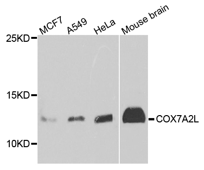 COX7A2L Antibody - Western blot analysis of extract of various cells.