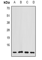 COX7A2L Antibody - Western blot analysis of COX7A2L expression in MCF7 (A); A549 (B); HeLa (C); mouse brain (D) whole cell lysates.