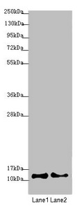 COX7A2L Antibody - Western blot All Lanes:COX7A2L antibody at 2.08 ug/ml Lane 1: A549 whole cell lysate Lane 2: HepG-2 whole cell lysate Secondary Goat polyclonal to rabbit IgG at 1/10000 dilution Predicted band size: 13 kDa Observed band size: 13 kDa