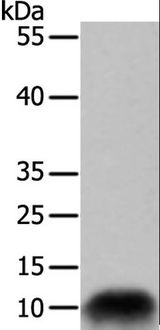 COX7B Antibody - Western blot analysis of 293T cell, using COX7B Polyclonal Antibody at dilution of 1:700.