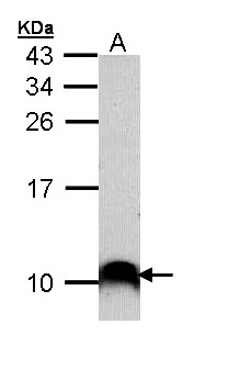 COX7B2 Antibody - Sample (30 ug of whole cell lysate). A: A431 . 15% SDS PAGE. COX7B2 antibody diluted at 1:1000.