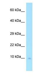 COX7C Antibody - COX7C antibody Western Blot of Human heart.  This image was taken for the unconjugated form of this product. Other forms have not been tested.