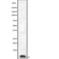 COX8C Antibody - Western blot analysis of Cytochrome c Oxidase 8C using Jurkat whole cells lysates