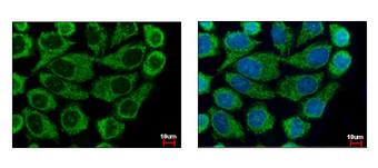 COXG / COX6B1 Antibody - COX6B1 antibody [N2C3] detects COX6B1 protein at mitochondria by immunofluorescent analysis. A431 cells were fixed in 4% paraformaldehyde at RT for 15 min. COX6B1 protein stained by COX6B1 antibody [N2C3] diluted at 1:500. 