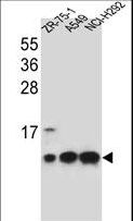 COXG / COX6B1 Antibody - COX6B1 Antibody western blot of ZR-75-1,A549,NCI-H292 cell line lysates (35 ug/lane). The COX6B1 antibody detected the COX6B1 protein (arrow).