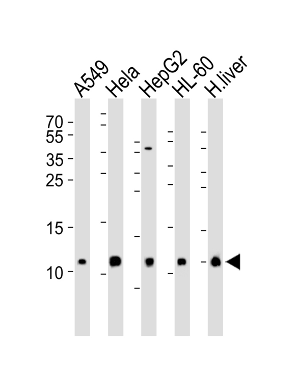 COXG / COX6B1 Antibody - Western blot of lysates from A549, HeLa, HepG2, HL-60 cell line and human liver tissue lysate (from left to right) with COX6B1 Antibody. Antibody was diluted at 1:1000 at each lane. A goat anti-rabbit IgG H&L (HRP) at 1:5000 dilution was used as the secondary antibody. Lysates at 35 ug per lane.