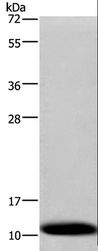 COXG / COX6B1 Antibody - Western blot analysis of Human fetal liver tissue, using COX6B1 Polyclonal Antibody at dilution of 1:1200.