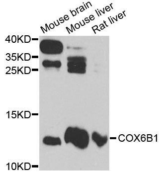 COXG / COX6B1 Antibody - Western blot analysis of extracts of various cell lines, using COX6B1 antibody at 1:3000 dilution. The secondary antibody used was an HRP Goat Anti-Rabbit IgG (H+L) at 1:10000 dilution. Lysates were loaded 25ug per lane and 3% nonfat dry milk in TBST was used for blocking. An ECL Kit was used for detection and the exposure time was 10s.