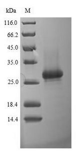 rnfH Protein - (Tris-Glycine gel) Discontinuous SDS-PAGE (reduced) with 5% enrichment gel and 15% separation gel.