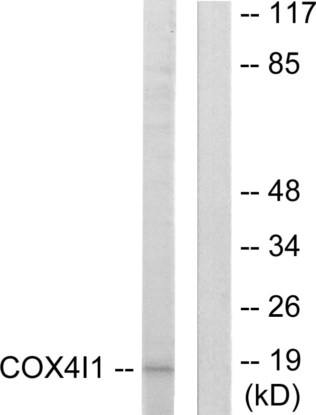 COXIV / COX4 Antibody - Western blot analysis of lysates from A549 cells, using COX41 Antibody. The lane on the right is blocked with the synthesized peptide.
