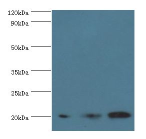 COXIV / COX4 Antibody - Western blot. All lanes: COX4I1 antibody at 5 ug/ml. Lane 1: MCF-7 whole cell lysate. Lane 2: A549 whole cell lysate. Lane 3: HepG2 whole cell lysate. Secondary antibody: Goat polyclonal to rabbit at 1:10000 dilution. Predicted band size: 20 kDa. Observed band size: 20 kDa.