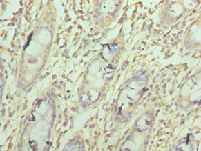 COXIV / COX4 Antibody - Immunohistochemistry of paraffin-embedded human colon tissue using COX4I1 Antibody at dilution of 1:100