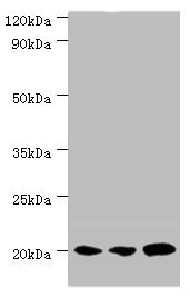 COXIV / COX4 Antibody - Western blot All lanes: COX4I1 antibody at 5µg/ml Lane 1: MCF-7 whole cell lysate Lane 2: A549 whole cell lysate Lane 3: HepG2 whole cell lysate Secondary Goat polyclonal to rabbit IgG at 1/10000 dilution Predicted band size: 20 kDa Observed band size: 20 kDa