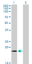 COXIV / COX4 Antibody - Western blot of COX4I1 expression in transfected 293T cell line by COX4I1 antibody.