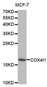 COXIV / COX4 Antibody - Western blot analysis of extracts of MCF-7 cells, using COX4I1 antibody. The secondary antibody used was an HRP Goat Anti-Rabbit IgG (H+L) at 1:10000 dilution. Lysates were loaded 25ug per lane and 3% nonfat dry milk in TBST was used for blocking.