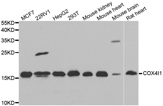 COXIV / COX4 Antibody - Western blot analysis of extracts of various cell lines.