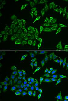 COXIV / COX4 Antibody - Immunofluorescence analysis of HeLa cells.
