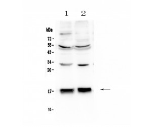 COXIV / COX4 Antibody - Western blot analysis of COX IV using anti-COX IV antibody