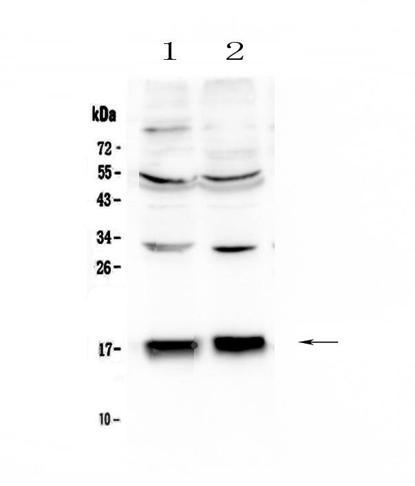 COXIV / COX4 Antibody - Western blot analysis of COX IV using anti-COX IV antibody. Electrophoresis was performed on a 5-20% SDS-PAGE gel at 70V (Stacking gel) / 90V (Resolving gel) for 2-3 hours. The sample well of each lane was loaded with 50ug of sample under reducing conditions. Lane 1: human HepG2 whole cell lysates,Lane 2: human SGC-7901 whole cell lysates. After Electrophoresis, proteins were transferred to a Nitrocellulose membrane at 150mA for 50-90 minutes. Blocked the membrane with 5% Non-fat Milk/ TBS for 1.5 hour at RT. The membrane was incubated with rabbit anti-COX IV antigen affinity purified polyclonal antibody at 0.5 µg/mL overnight at 4°C, then washed with TBS-0.1% Tween 3 times with 5 minutes each and probed with a goat anti-rabbit IgG-HRP secondary antibody at a dilution of 1:10000 for 1.5 hour at RT. The signal is developed using an Enhanced Chemiluminescent detection (ECL) kit with Tanon 5200 system. A specific band was detected for COX IV at approximately 17KD. The expected band size for COX IV is at 20KD.