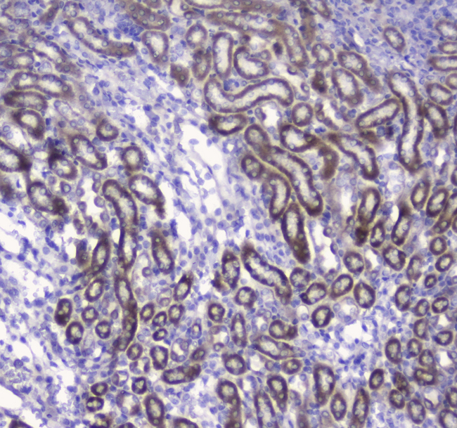 COXIV / COX4 Antibody - IHC analysis of COX IV using anti-COX IV antibody. COX IV was detected in paraffin-embedded section of mouse kidney tissue. Heat mediated antigen retrieval was performed in citrate buffer (pH6, epitope retrieval solution) for 20 mins. The tissue section was blocked with 10% goat serum. The tissue section was then incubated with 2µg/ml rabbit anti-COX IV Antibody overnight at 4°C. Biotinylated goat anti-rabbit IgG was used as secondary antibody and incubated for 30 minutes at 37°C. The tissue section was developed using Strepavidin-Biotin-Complex (SABC) with DAB as the chromogen.