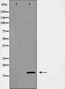 COXIV / COX4 Antibody - Western blot analysis of COX IV expression in Jurkat cells. The lane on the left is treated with the antigen-specific peptide.