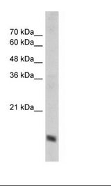 COXIV / COX4 Antibody - HepG2 Cell Lysate.  This image was taken for the unconjugated form of this product. Other forms have not been tested.