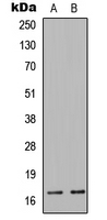 COXIV / COX4 Antibody - Western blot analysis of COX4-1 expression in HepG2 (A); Jurkat (B) whole cell lysates.