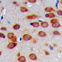 COXIV / COX4 Antibody - Immunohistochemical analysis of COX4-1 staining in human brain formalin fixed paraffin embedded tissue section. The section was pre-treated using heat mediated antigen retrieval with sodium citrate buffer (pH 6.0). The section was then incubated with the antibody at room temperature and detected using an HRP conjugated compact polymer system. DAB was used as the chromogen. The section was then counterstained with hematoxylin and mounted with DPX. w