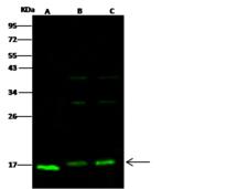 COXIV / COX4 Antibody - Anti-COX4I1 rabbit polyclonal antibody at 1:500 dilution. Lane A: NIH3T3 Whole Cell Lysate. Lane B: Jurkat Whole Cell Lysate. Lane C: Hela Whole Cell Lysate. Lysates/proteins at 30 ug per lane. Secondary: Goat Anti-Rabbit IgG H&L (Dylight 800) at 1/10000 dilution. Developed using the Odyssey technique. Performed under reducing conditions. Predicted band size: 15 kDa. Observed band size: 17 kDa. (We are unsure as to the identity of these extra bands.)