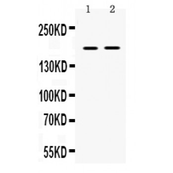 CP / Ceruloplasmin Antibody - Western blot analysis of Ceruloplasmin expression in rat skeletal muscle extract (lane 1), and NIH3T3 whole cell lysates (lane 2). Ceruloplasmin at 180 kD was detected using rabbit anti- Ceruloplasmin Antigen Affinity purified polyclonal antibody at 0.5 ug/mL. The blot was developed using chemiluminescence (ECL) method.