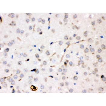 CP / Ceruloplasmin Antibody - Ceruloplasmin was detected in paraffin-embedded sections of rat brain tissues using rabbit anti- Ceruloplasmin Antigen Affinity purified polyclonal antibody at 1 ug/mL. The immunohistochemical section was developed using SABC method.