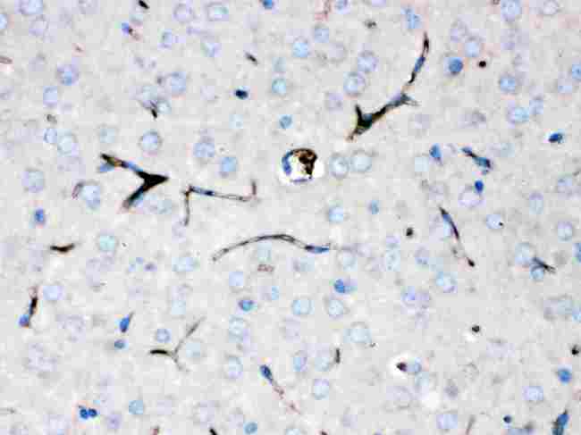 CP / Ceruloplasmin Antibody - IHC analysis of Ceruloplasmin/CP using anti-Ceruloplasmin/CP antibody. Ceruloplasmin/CP was detected in paraffin-embedded section of mouse brain tissues. Heat mediated antigen retrieval was performed in citrate buffer (pH6, epitope retrieval solution) for 20 mins. The tissue section was blocked with 10% goat serum. The tissue section was then incubated with 1µg/ml rabbit anti-Ceruloplasmin/CP Antibody overnight at 4°C. Biotinylated goat anti-rabbit IgG was used as secondary antibody and incubated for 30 minutes at 37°C. The tissue section was developed using Strepavidin-Biotin-Complex (SABC) with DAB as the chromogen.
