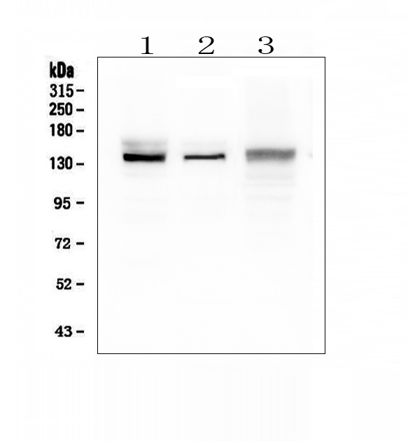 CP / Ceruloplasmin Antibody - Western blot analysis of Ceruloplasmin/CP using anti-Ceruloplasmin/CP antibody. Electrophoresis was performed on a 5-20% SDS-PAGE gel at 70V (Stacking gel) / 90V (Resolving gel) for 2-3 hours. The sample well of each lane was loaded with 50ug of sample under reducing conditions. Lane 1: rat liver tissue lysates, Lane 2: mouse liver tissue lysates, Lane 3: mouse HEPA1-6 whole cell lysates. After Electrophoresis, proteins were transferred to a Nitrocellulose membrane at 150mA for 50-90 minutes. Blocked the membrane with 5% Non-fat Milk/ TBS for 1.5 hour at RT. The membrane was incubated with rabbit anti-Ceruloplasmin/CP antigen affinity purified polyclonal antibody at 0.5 µg/mL overnight at 4°C, then washed with TBS-0.1% Tween 3 times with 5 minutes each and probed with a goat anti-rabbit IgG-HRP secondary antibody at a dilution of 1:10000 for 1.5 hour at RT. The signal is developed using an Enhanced Chemiluminescent detection (ECL) kit with Tanon 5200 system. A specific band was detected for Ceruloplasmin/CP at approximately 140KD. The expected band size for Ceruloplasmin/CP is at 122KD.