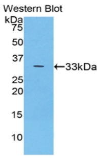 CP / Ceruloplasmin Antibody - Western blot of recombinant CP / Ceruloplasmin.  This image was taken for the unconjugated form of this product. Other forms have not been tested.