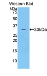 CP / Ceruloplasmin Antibody - Western blot of recombinant CP / Ceruloplasmin.  This image was taken for the unconjugated form of this product. Other forms have not been tested.