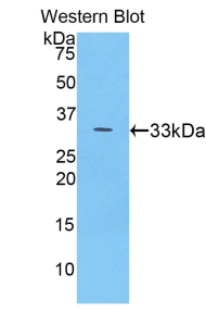 CP / Ceruloplasmin Antibody - Western blot of recombinant CP / Ceruloplasmin.  This image was taken for the unconjugated form of this product. Other forms have not been tested.