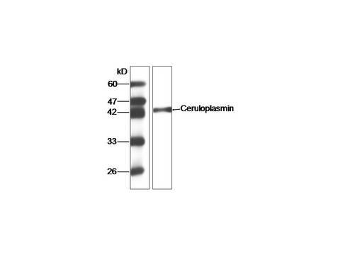 CP / Ceruloplasmin Antibody